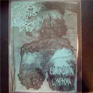 Rigor Mortis In A Frozen Body, Colorectal Lymphoma - Split