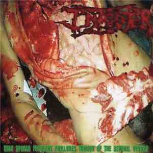 Infester  - Wide Spread Feculent Phyllodes Tumour Of The Seminal Vesicle