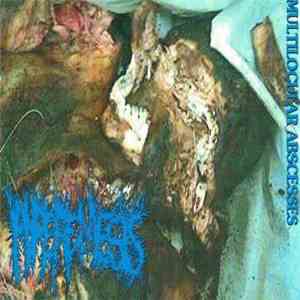 Hyperemesis / Rotocles - Multilocular Abscesses / Mincecore Way