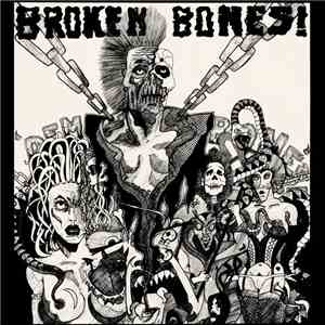 Broken Bones! - Dem Bones