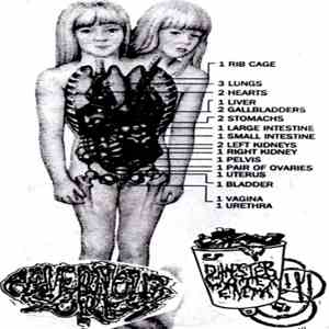 Cavernous Sores, Dumpster Water Enema - Split Tape
