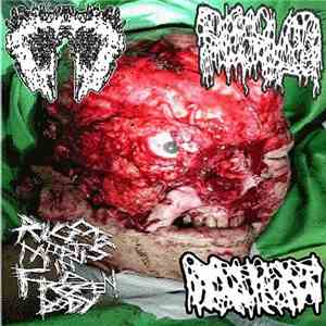 Carcinomas Of Unknown Primary Origin, Dissolved , Rigor Mortis In A Frozen ...
