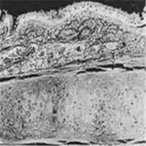 Pulse Emitter - Lung