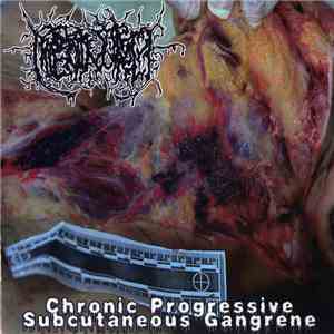 Hipermenorrea / Cannibe - Chronic Progressive Subcutaneous Gangrene / Labor ...