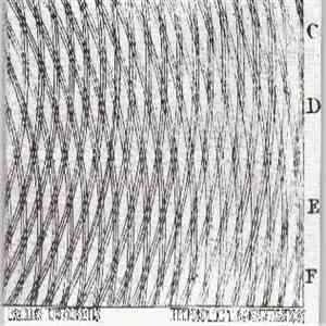 Facies Deformis - Hypnotic Transmission