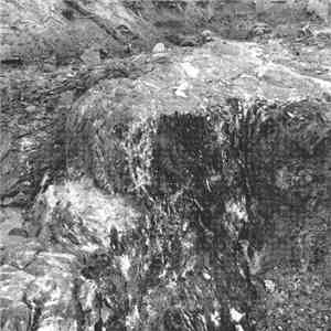 Syndrome - Floating Veins