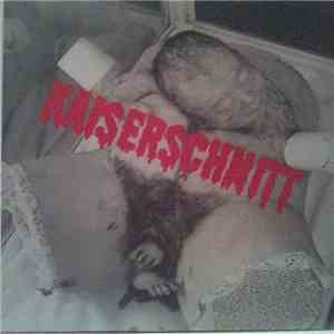 Kaiserschnitt - Kaiserschnitt