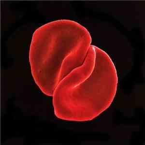 Peter Gabriel - Scratch My Back