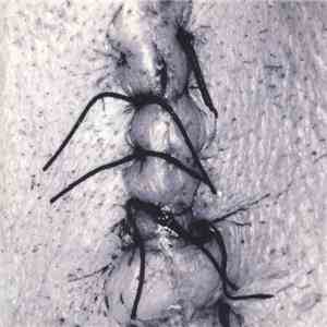 Scheer - Infliction
