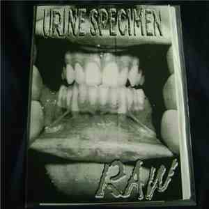 Urine Specimen - Raw EP