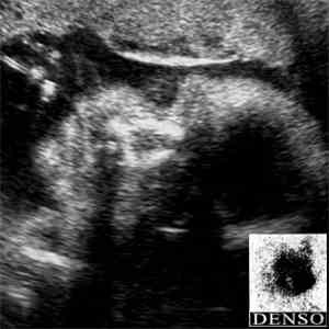 DENSO - 090515 / Aglaia