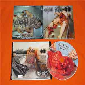 Cannibe / Septic Autopsy / Infected Gastroenteritis - 3 Ways Of Infected Au ...