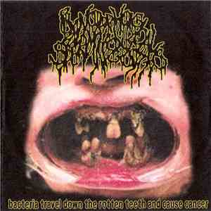 BxSx - Bacteria Travel Down The Rotten Teeth And Cause Cancer
