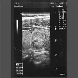 Systemic Inflammatory Response Syndrome - Internal Unrest